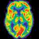 Illustration for article titled Women Have No Emotional Feelings During Orgasm, Say Neuroscientists